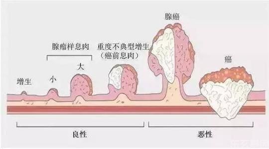 基因检测有助于结直肠癌的筛查工作(图2)