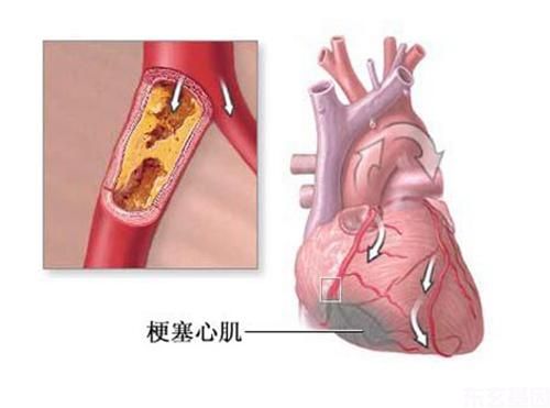 联合干细胞治疗心肌梗死--超修复之路。(图2)