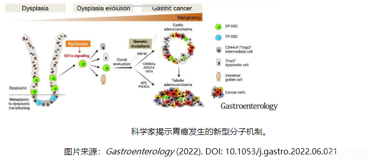 Gastroenterology：科学家揭示胃癌发生的新型分子机制(图1)